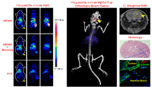 Potential of YY146, an anti-CD146 monoclonal antibody, for imaging of brain malignancies.