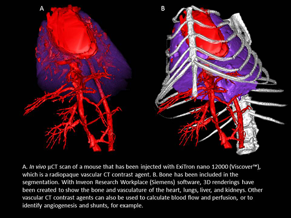 Left, an in vivo μCT scan of a mouse that has been injected with ExiTron nano 12000, a radiopaque vascular agent. Right, bone included in the segmentation.