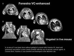 Top, in vivo μCT scan (axial slices without gating) of a mouse with Fenestra VC. Heart and pulmonary vasculature is more clearly resolved with the use of vascular contrast agents. Bottom, coronal slices.