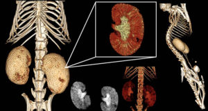 Collage of 3D renderings and maximum intensity projection (MIP) images from an in vivo μCT scan of a mouse with an Ultravist © (lopromide) intravenous injection.