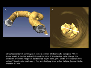 3D surface-rendered μCT images of excised, contrast filled colon of a transgenic PIRC rat tumor model. Left, surface and axial slices of the colon. Right, endoluminal surface image.