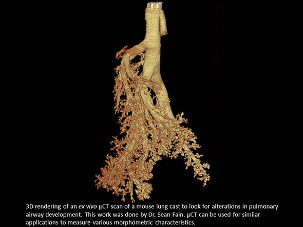 3D rendering of an ex vivo μCT scan of a mouse lung cast to look for alterations in pulmonary airway developoment.