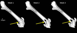 A control mouse's osteolytic tumor size increased dramatically in a three week span.