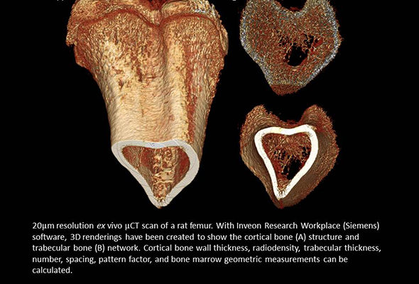 Three images of a rat femur, rendered in 3D to show, left, the cortical bone structure and, right, the trabecular bone network.