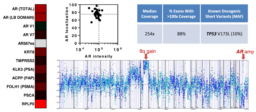 Multi-parametric analysis of gene expression, genomic profiling and Androgen Receptor (AR) protein from CTCs. (Gene expression data is shown as a heat map, where red indicates high expression, green low expression, and gray no detectable expression). AR protein analysis of CTCs is shown as a graph of AR nuclear localization verses AR intensity. Sequencing coverage and known oncogenic short variants detected using Foundation One genomic profiling shown with corresponding copy number plots (Clin Cancer Res 201657).