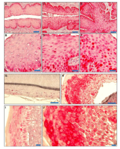 Figs. A - J of tissue samples from transgenic mice and wildtype controls