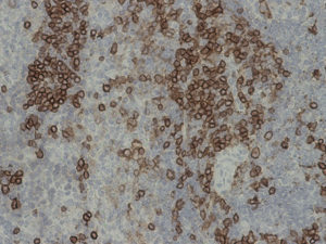 Anti CD4 immunohistochemistry on mouse spleen, 200X. 