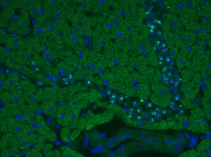 Anti-human nucleoli immunohistochemistry on mouse heart injected with human cardiocytes, 200X