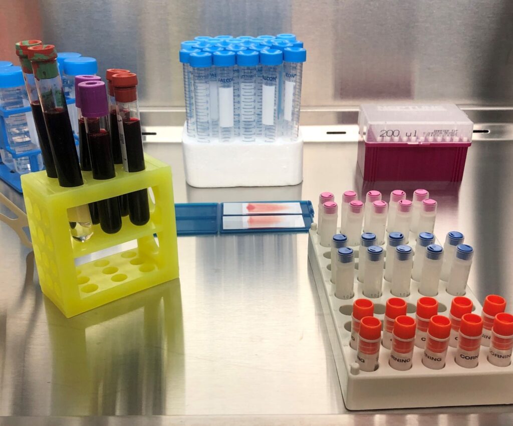Cancer Pharmacology Lab – Carbone Cancer Center – UW–Madison